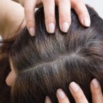 Why hair starts to turn gray and what you can do about it